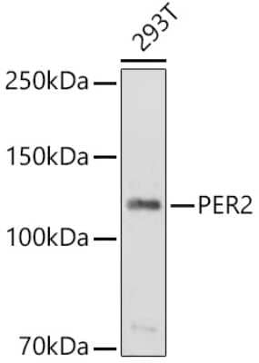 Western Blot: PER2 Antibody [NBP2-94634] - Western blot analysis of extracts of 293T cells, using PER2 antibody (NBP2-94634) at 1:1000 dilution. Secondary antibody: HRP Goat Anti-Rabbit IgG (H+L) at 1:10000 dilution. Lysates/proteins: 25ug per lane. Blocking buffer: 3% nonfat dry milk in TBST. Detection: ECL Basic Kit. Exposure time: 30s.